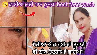 💁🏻 ਪੁਰਾਣੀਆਂ ਛਾਈਆਂ open pores ਕਰੇ ਦਸ ਦਿਨਾਂ ਚ ਠੀਕ [upl. by Yeniar]