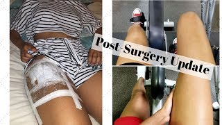 My Hip Labral Tear Ep 5  1 Week Post Surgery [upl. by Neville]