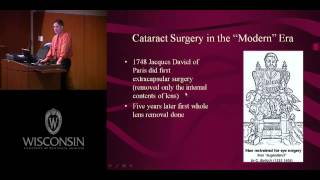 History of Cataract Surgery [upl. by Debbee]