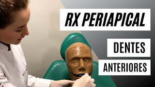 Como fazer radiografia periapical de dentes anteriores da forma correta [upl. by Yennej35]