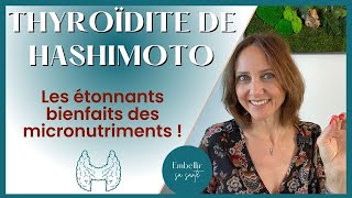 Hypothyroïdie d’Hashimoto régime alimentaire et solutions naturelles [upl. by Nesila]