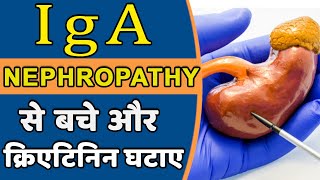 आईजीए नेफ्रोपैथी ठीक करने के तरीके  IgA Nephropathy Treatment in Hindi [upl. by Hank22]