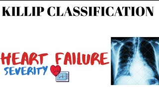 Killip Classification  Heart failure  cardiovascular system  medinject [upl. by Kenward]