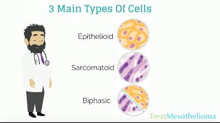 Mesothelioma Cell Types TreatMesotheliomaorg [upl. by Nixon]