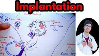 Implantation of BlastocystImplantation bleeding vs periodsImplantation symptoms in hindiurdu [upl. by Rockafellow]