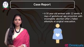 Hyesteroscopic Removal Of Retained Products Of Conception In Bicornuate Uterus [upl. by Trammel]