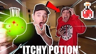 Insane Ordering ITCHY Potion and using it on ImJayStation It Worked [upl. by Aelam]