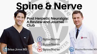 Post Herpetic Neuralgia A Review and Journal Club [upl. by Enrico903]