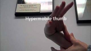 Hypermobility Ligamentous Laxity in the Female Athlete Dallas TX [upl. by Nymzaj242]