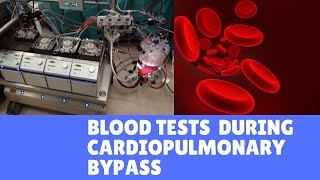 Blood Tests during Cardiopulmonary Bypass [upl. by Irrabaj]