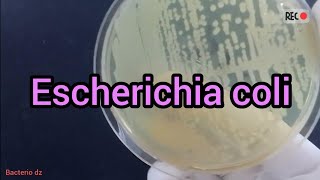 Escherichia coli isoler sur gélose nutritive [upl. by Aissatsana]