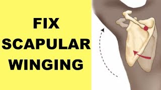 How to Fix Winged Scapula Winged Scapula Exercises [upl. by Secunda]