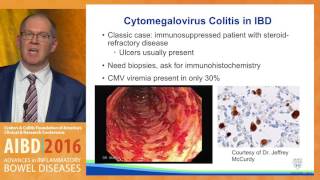 Diagnosis and management of infections in IBD patients on immunomodulators and biologics [upl. by Oicaro]