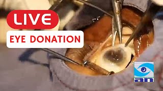 Live eye donation  ಕಣ್ಣಿನ ದಾನ ಲೈವ್  Abhishek Nethradhama [upl. by Zerelda734]