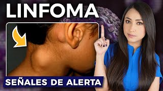 ¿Qué es un LINFOMA l Señales de ALERTA👩🏻‍⚕️ drapauzuniga [upl. by Nerti]