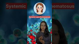 Systemic lupus erythematosus SLE animalphysiology csirnet gate neet cuet csirnetlifescience [upl. by Aynodal]