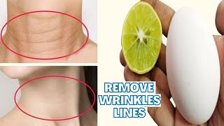 How to remove Neck WrinklesLines permanently  Remove neck lines home remedy  Natural Beauty Tips [upl. by Arayc]