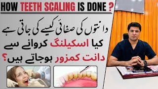 How Scaling is done   Teeth cleaning  Scaling and Polishing  Danton Ki Safai Kaise Karen [upl. by Tanah655]