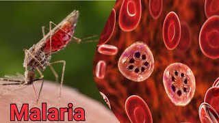 Malaria Species life cycle amp diagnosis pathology hematology pathologylab smear [upl. by Lula]