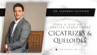 Tudo Sobre Cicatrizes e Queloides na Cirurgia Plástica [upl. by Zaria29]