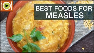 Best Foods to Cure Measles  Healthy Recipes [upl. by Htyderem800]