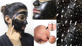 CHARCOAL Peel Off Mask Does It Work हिंदी ReviewSuper Style Tips [upl. by Norrag]