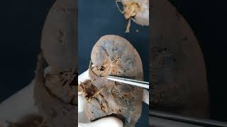 RENAL PARTE 7  Anatomia humana Shorts medicina anatomia aula anatomy biologia [upl. by Inilam201]