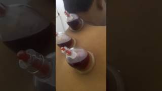 Dr Hussains hijama [upl. by Greenwood]