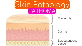 Skin Pathology PATHOMA 2  Blistering Dermatoses  Epithelial Tumors [upl. by Kirbee498]