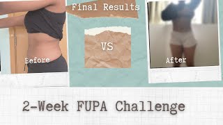 Last Days with my FUPA Preop Info Smooth Tuck TM Skin Removal Weight loss amp more [upl. by Graniah]