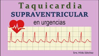 Taquicardia SUPRAVENTRICULAR en urgencias [upl. by Alvin638]