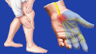 Paresthesia Causes And Symptoms [upl. by Nosac]