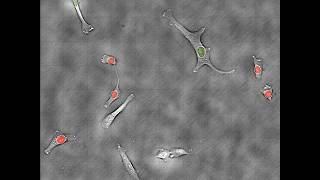 Human HT1080 Fibrosarcoma Cells on Etaluma LS600 [upl. by Thant]