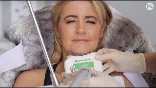 My Coolsculpting Fat Freeze Experience  Is it worth the money [upl. by Norrehc]