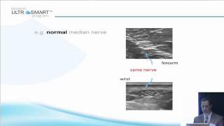 Terasons MSK Ultrasound Basics with Dr Visco Part 5 of 8 [upl. by Eitak409]