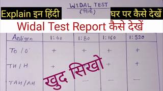 घर पर टायफायड रिपोर्ट कैसे चैक करें  How To Read Typhoid Widal Test Report At Home [upl. by Doll]