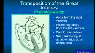 Congenital Heart Disease in Adults [upl. by Namwob]