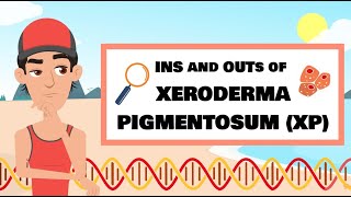 The Ins and Outs of XP Xeroderma pigmentosum [upl. by Anirpas]