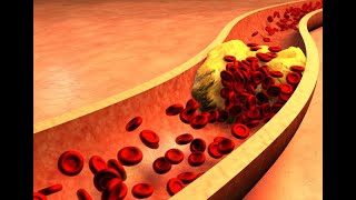 LDL cholesterol and atherosclerotic cardiovascular disease Mechanisms [upl. by Birdella]