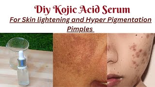 Diy Kojic Acid SerumHomemade Kojic Acid Serum makingKojic Acid Serum [upl. by Cyb]