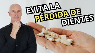 Alerta Roja DIENTES FLOJOS Descubre cómo salvar tus dientes en 5 minutos [upl. by Johann690]