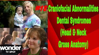 Craniofacial amp Dental Syndromes INBDE Dental Boards [upl. by Fenton587]