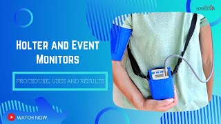 Holter and Event Monitors Procedure Uses and Results [upl. by Tory375]