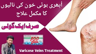 What is varicose veins Varicose veins treatment In urdu  ubhari hui naso ka ilaj [upl. by Lelia]