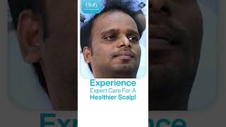 Best Dandruff Treatment in Chennai  Elixify [upl. by Sehguh2]