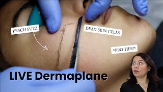 LIVE DERMAPLANE QampA WITH MASTER AESTHETICIAN  Skincare [upl. by Eudoca]