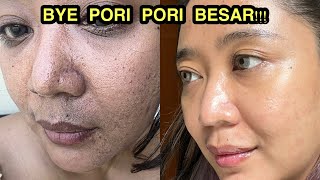 SKINCARE ROUTINE UNTUK SI PORI PORI BESAR  Cara Gampang Mengecilkan Pori Pori Besar dan Komedo [upl. by Muhammad]