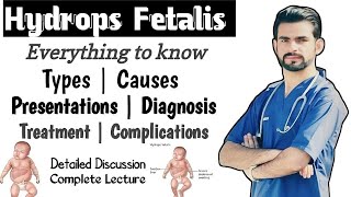 Hydrops Fetalis  causes types management complications [upl. by Iemaj116]