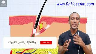 وداعا Minoxidil واهلا Stemoxydine الافضل عالميا لعلاج تساقط الشعر [upl. by Dreyer]