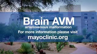 Dr Bernard Bendok Arteriovenous Malformation  Brain AVM [upl. by Sirapal]